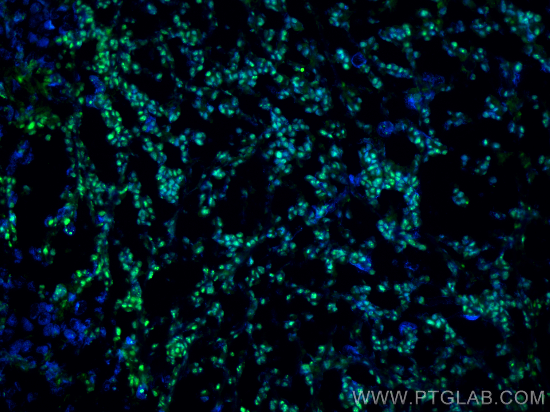 IF Staining of mouse breast cancer using 66490-1-Ig