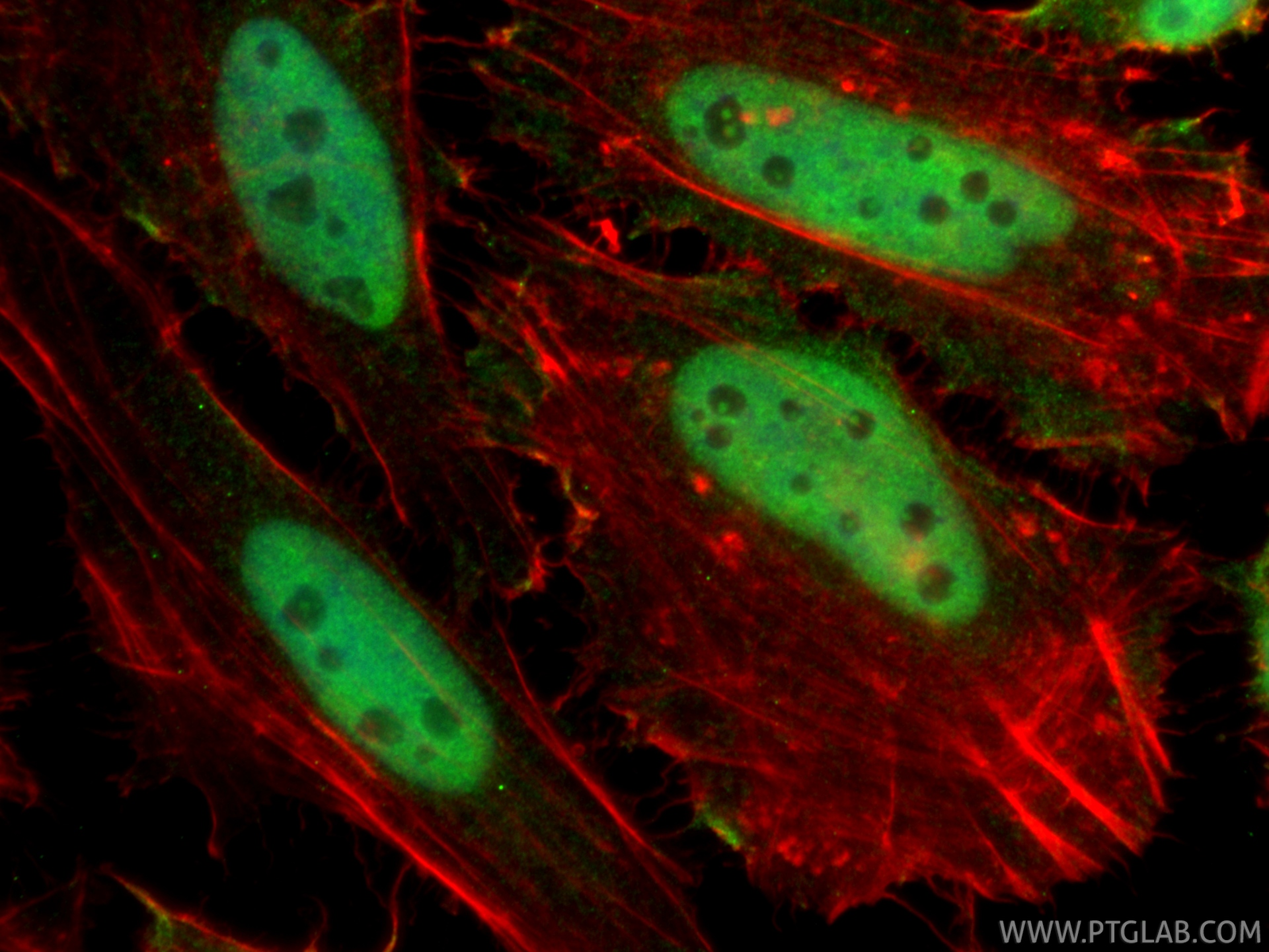 IF Staining of HeLa using 66490-1-Ig