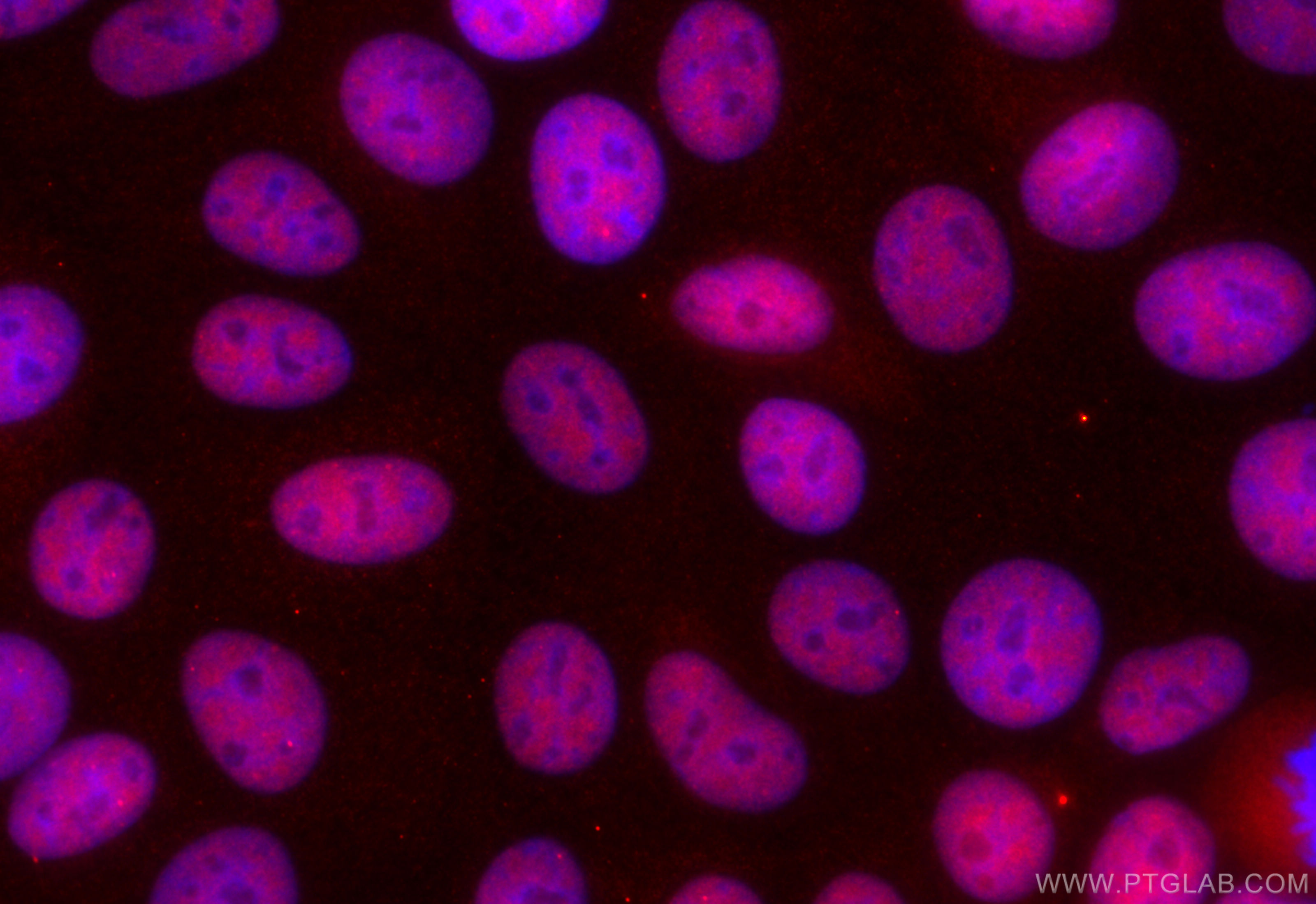IF Staining of MCF-7 using CL594-66490