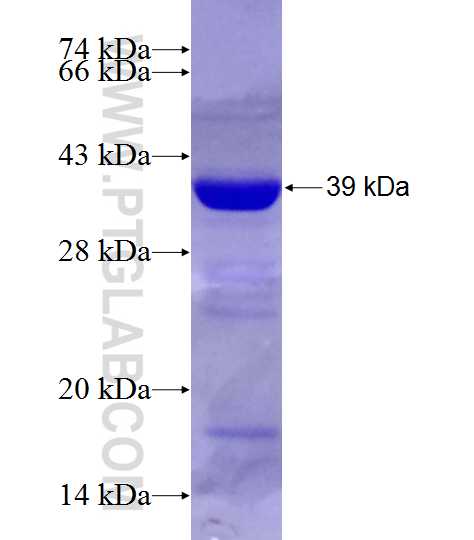 HRPT2; CDC73 fusion protein Ag28415 SDS-PAGE