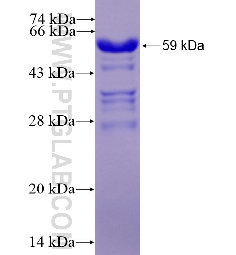 HRPT2; CDC73 fusion protein Ag2959 SDS-PAGE