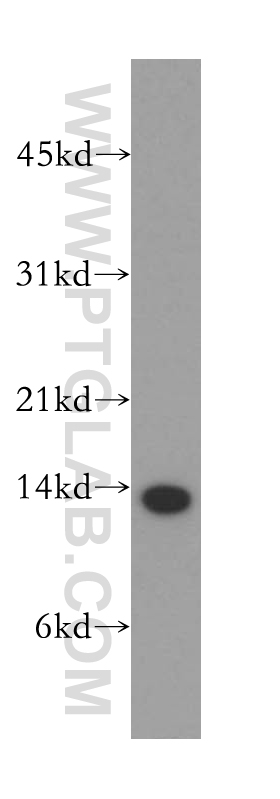 WB analysis of human liver using 12930-1-AP