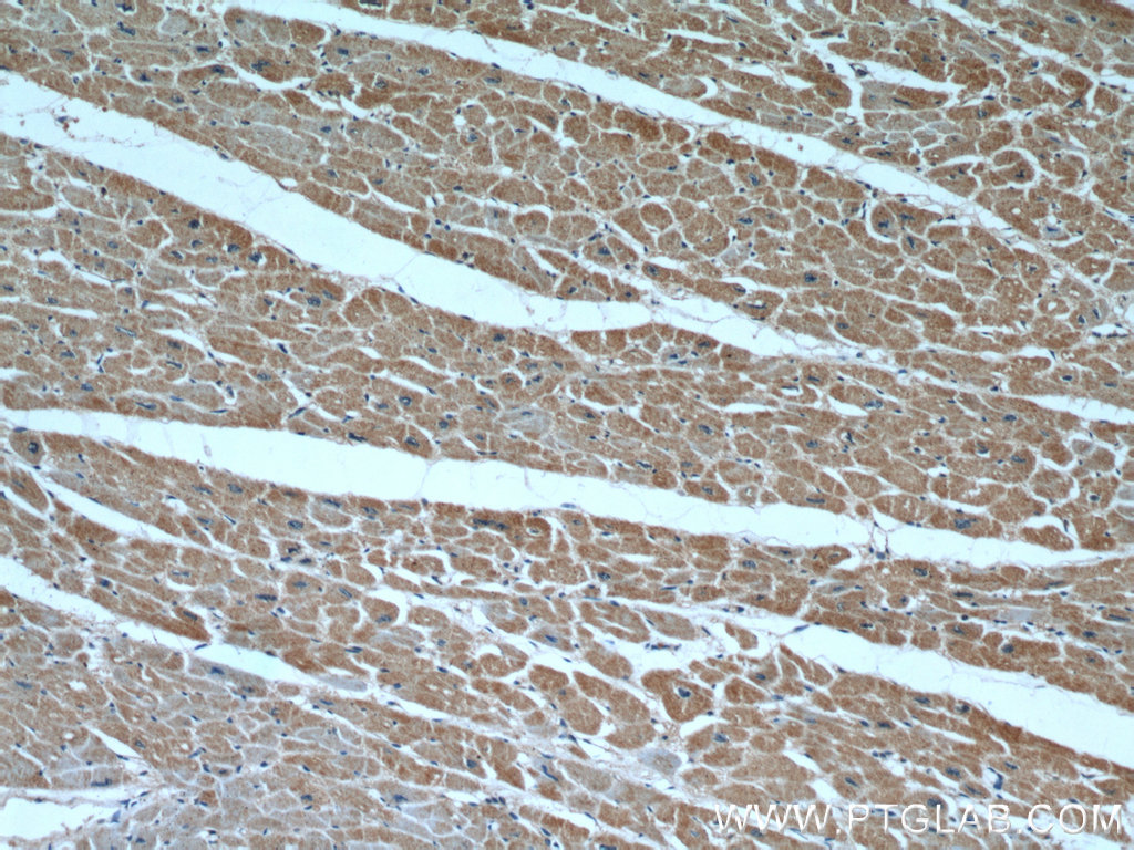 IHC staining of human heart using 14358-1-AP