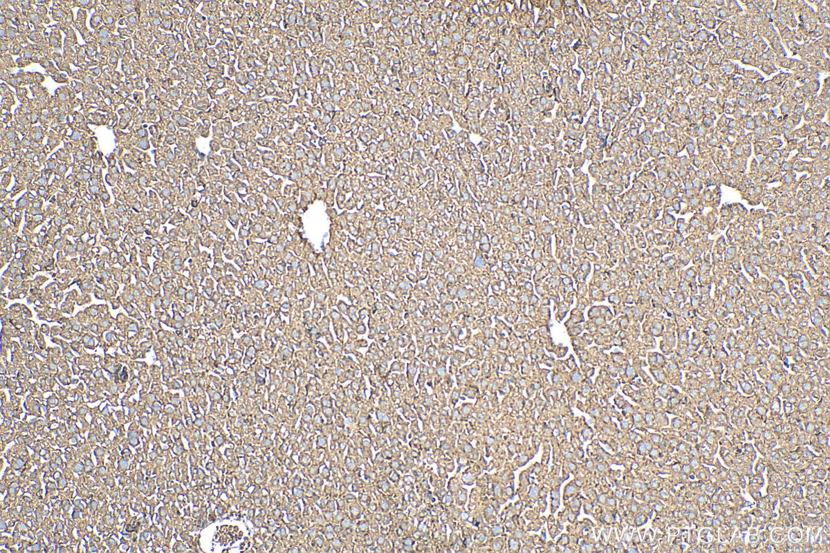 IHC staining of mouse liver using 10169-2-AP