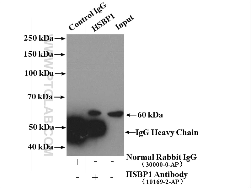 IP experiment of mouse brain using 10169-2-AP