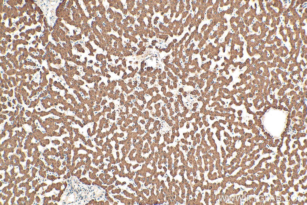 IHC staining of human liver using 10928-1-AP