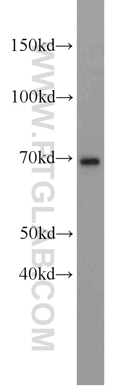 WB analysis of L02 using 10928-1-AP