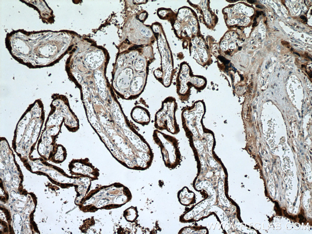 IHC staining of human placenta using 27830-1-AP