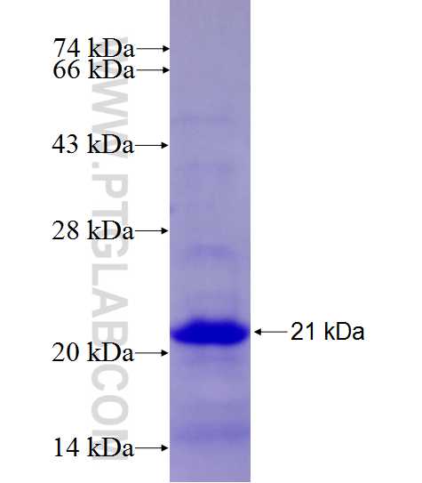 HSD17B1 fusion protein Ag27527 SDS-PAGE HSD17B1 fusion protein Ag27527 SDS-PAGE