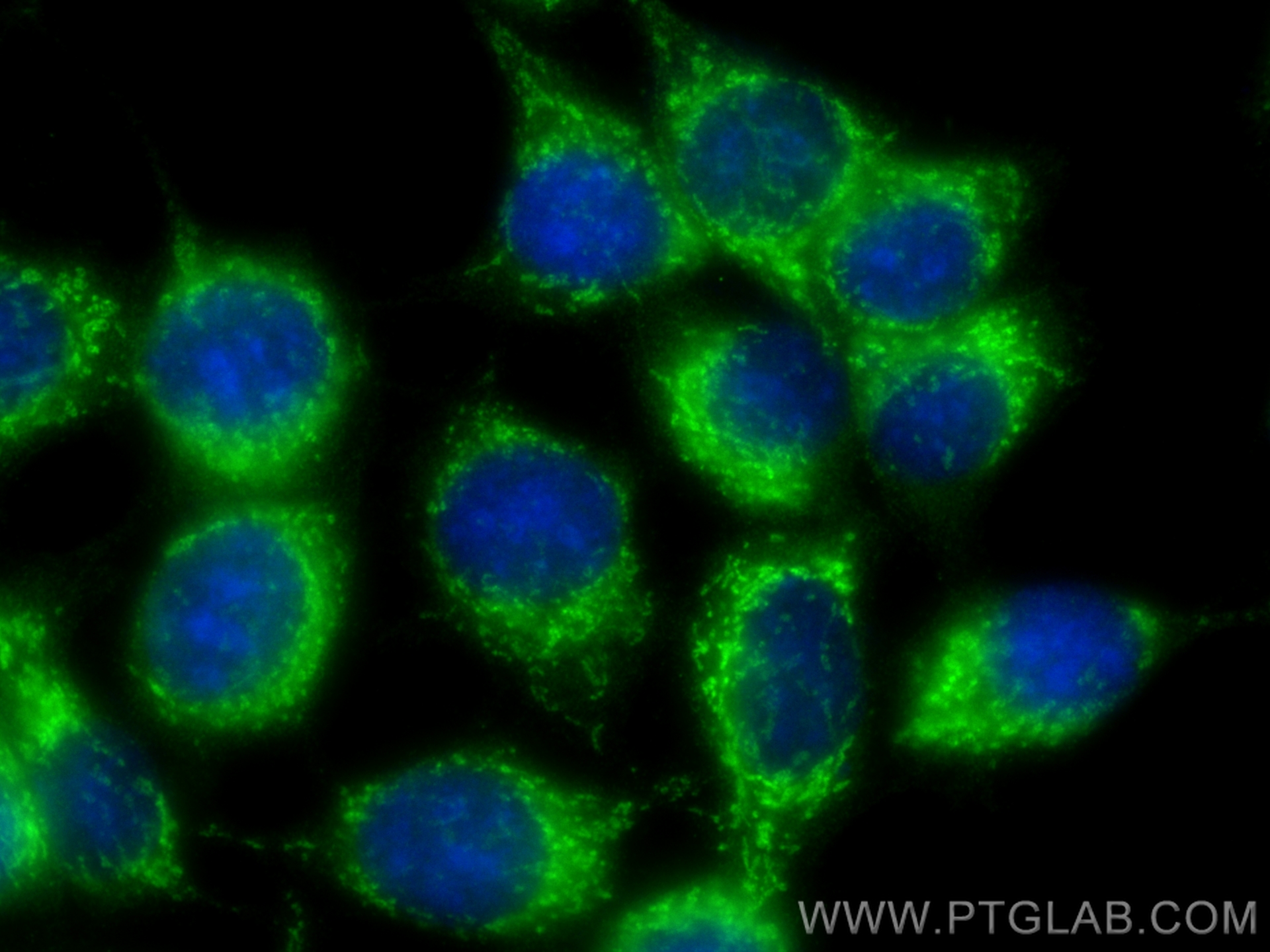 IF Staining of MCF-7 using 10648-1-AP