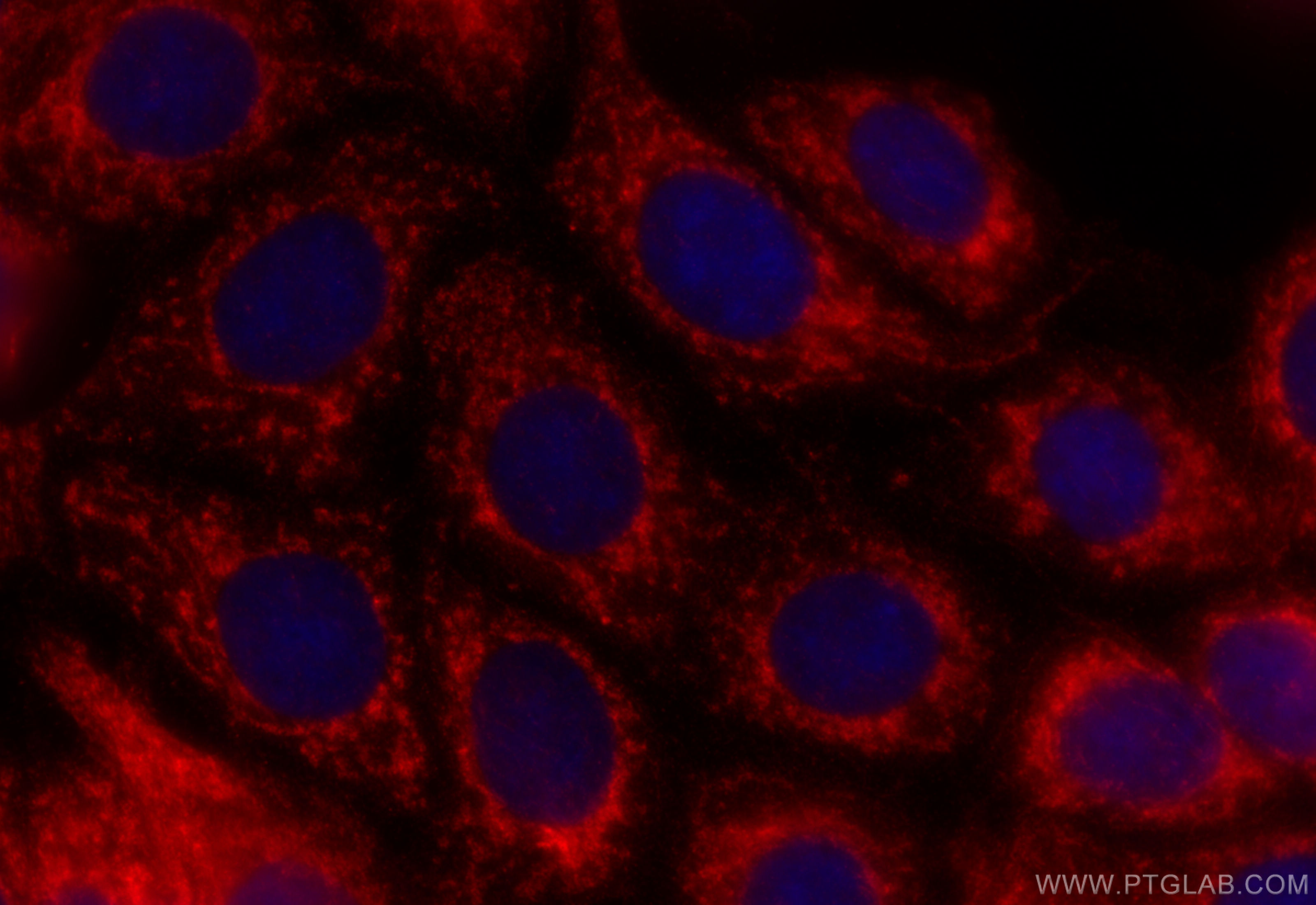 IF Staining of MCF-7 using 10648-1-AP