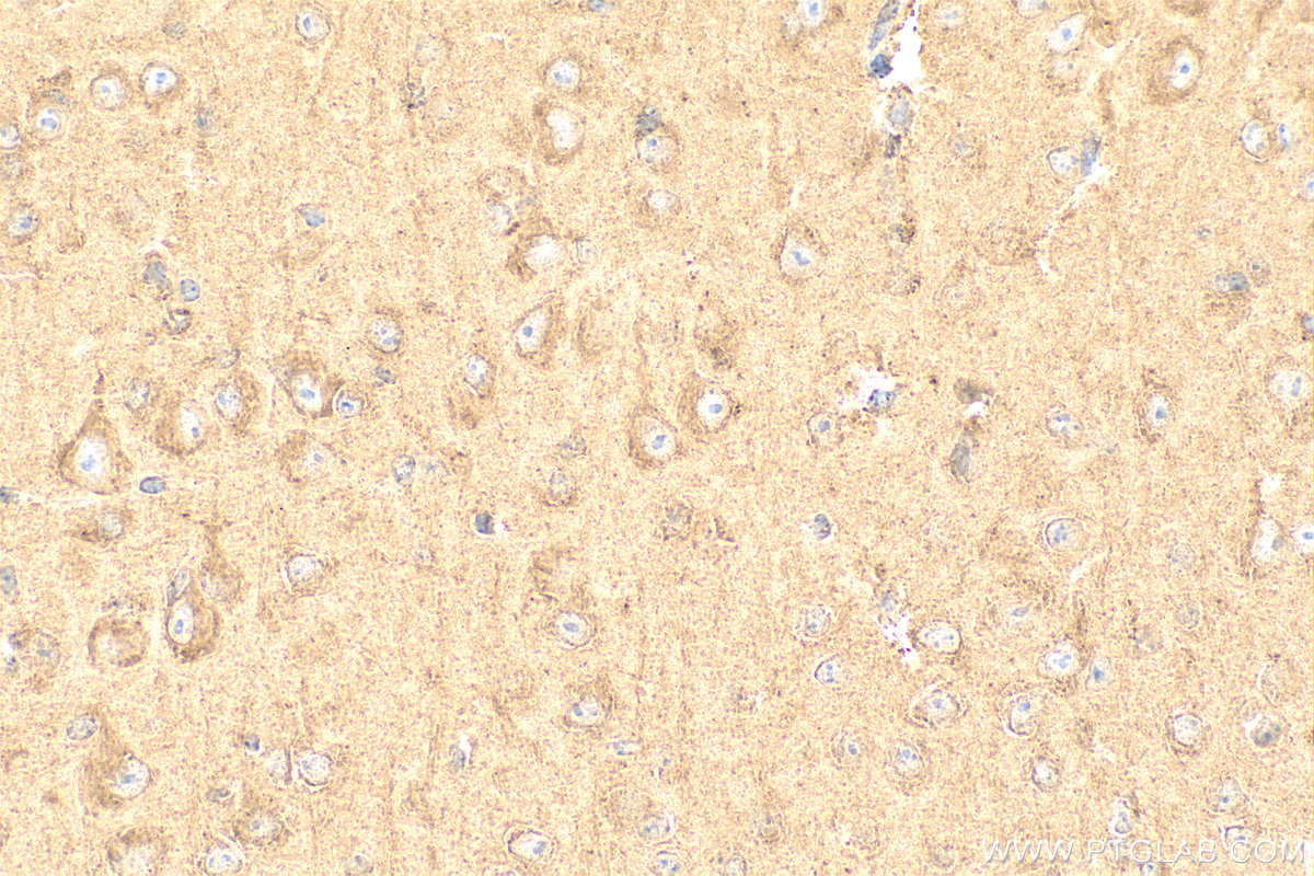 IHC staining of mouse brain using 10648-1-AP