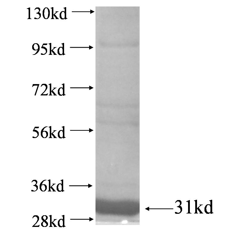 HSD17B10 fusion protein Ag4374 SDS-PAGE