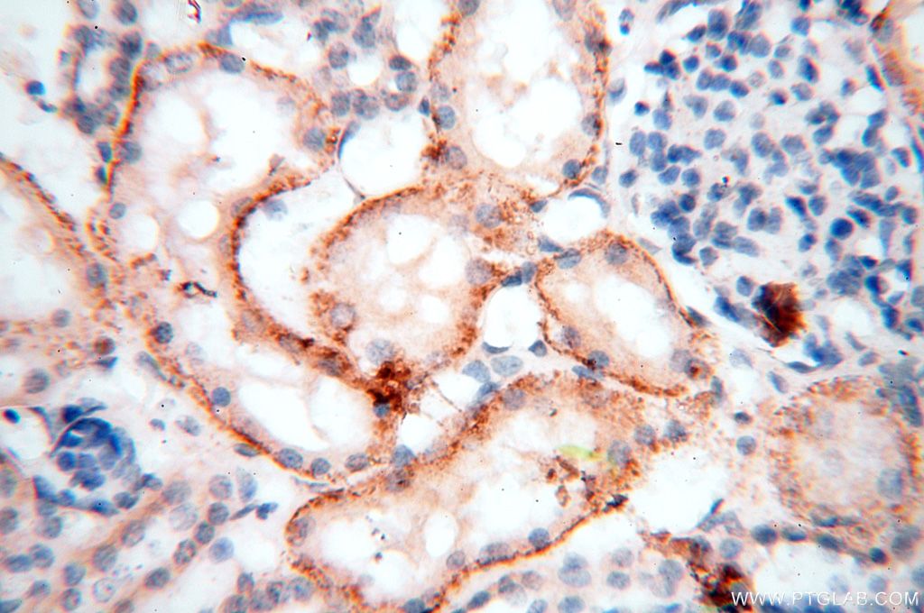 IHC staining of human kidney using 17301-1-AP