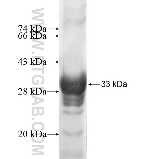 HSD17B11 fusion protein Ag11464 SDS-PAGE HSD17B11 fusion protein Ag11464 SDS-PAGE