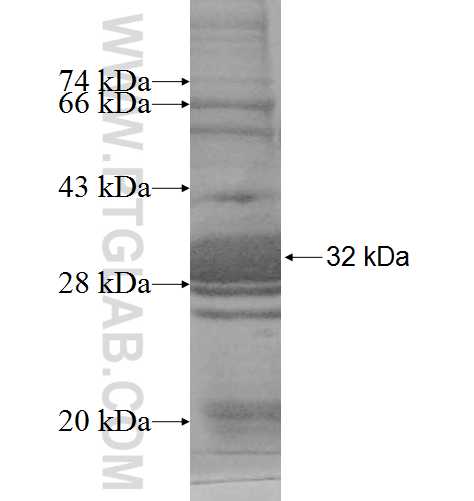 HSD17B11 fusion protein Ag9596 SDS-PAGE HSD17B11 fusion protein Ag9596 SDS-PAGE