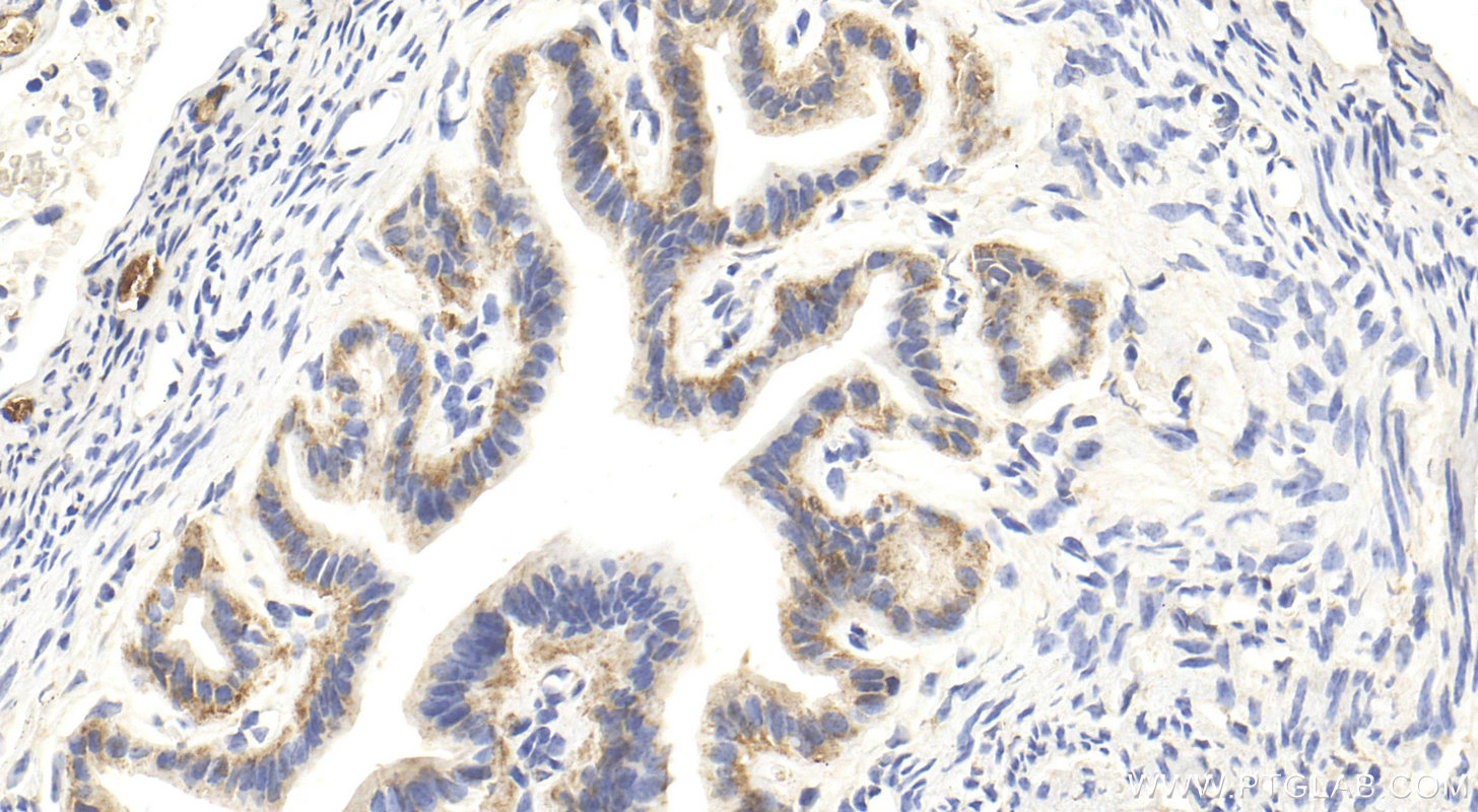 IHC staining of mouse ovary using 27461-1-AP