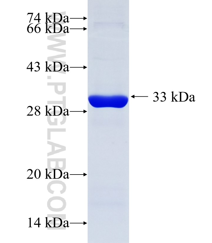 HSD17B12 fusion protein Ag34844 SDS-PAGE HSD17B12 fusion protein Ag34844 SDS-PAGE