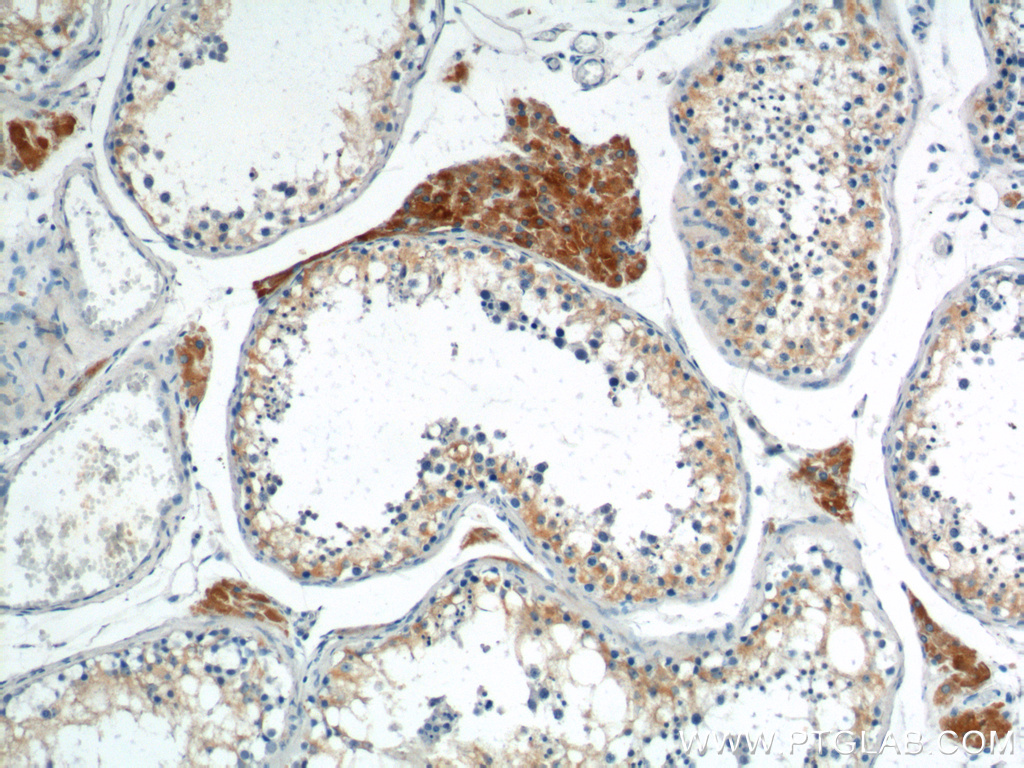 IHC staining of human testis using 13415-1-AP