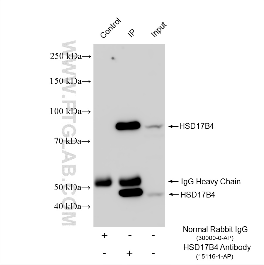 IP experiment of HeLa using 15116-1-AP