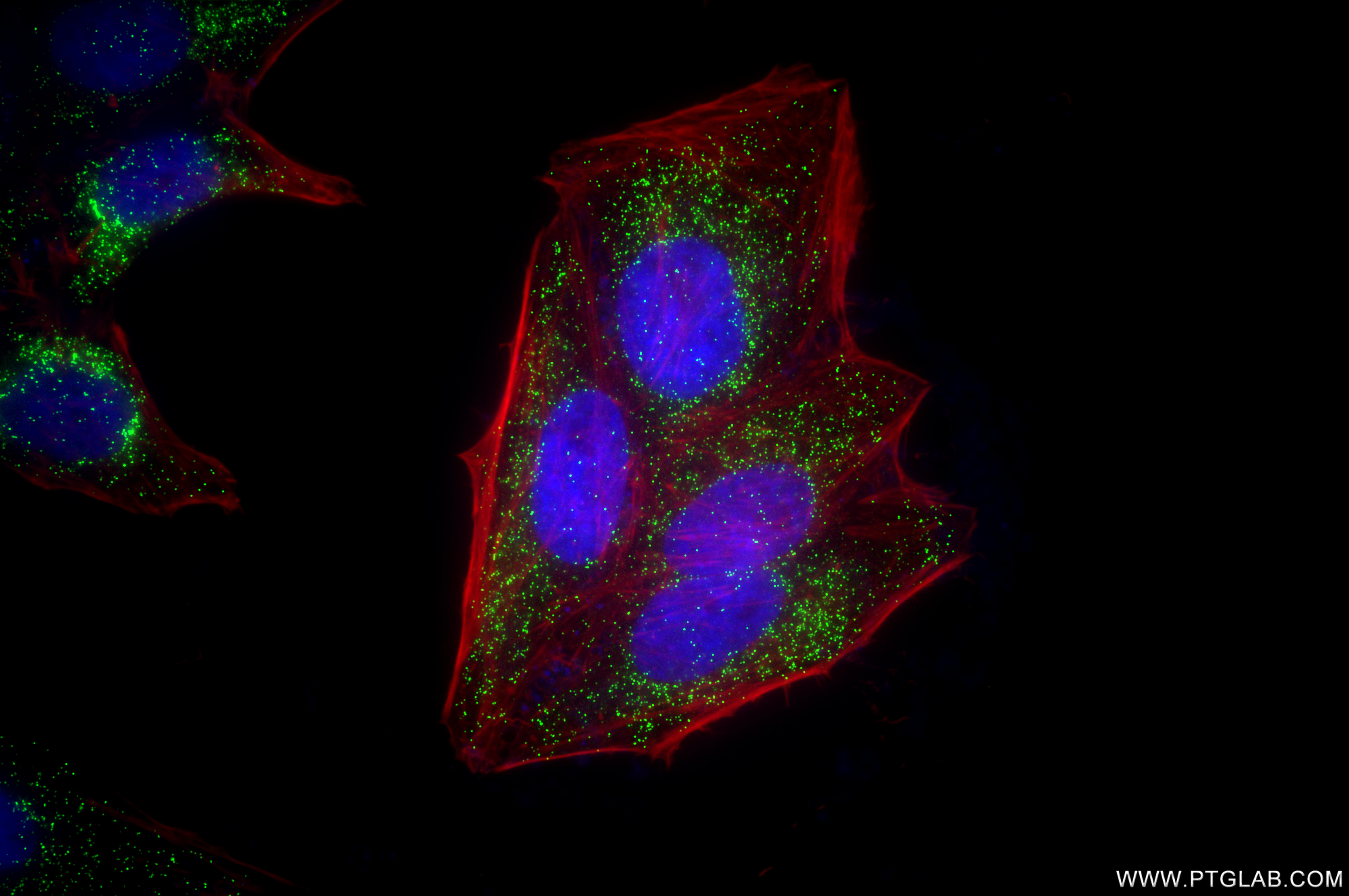 Immunofluorescent analysis of (4% PFA) fixed HeLa cells using HSD17B4 antibody (<a class='green' href='/productredirect?CatalogNo=86334-2-RR' target='_blank'>86334-2-RR</a>, Clone: 251058E1 ) at dilution of 1:500 and CoraLite®488-Conjugated Goat Anti-Rabbit IgG(H+L) (<a class='green' href='/productredirect?CatalogNo=SA00013-2' target='_blank'>SA00013-2</a>), CL594-Phalloidin (red). This data was developed using the same antibody clone with 86334-2-PBS in a different storage buffer formulation. IF Staining of HeLa using 86334-2-RR (same clone as 86334-2-PBS)