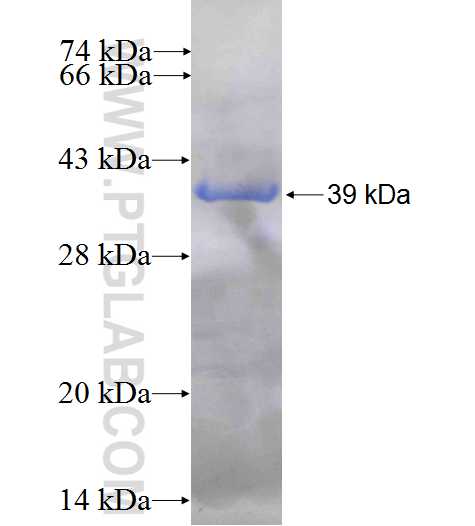 HSD17B4 fusion protein Ag7221 SDS-PAGE
