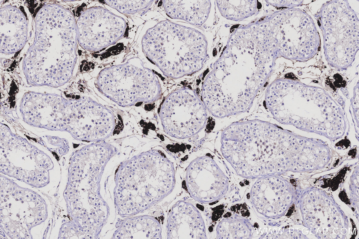 IHC staining of human testis using 67496-1-Ig IHC staining of human testis using 67496-1-Ig