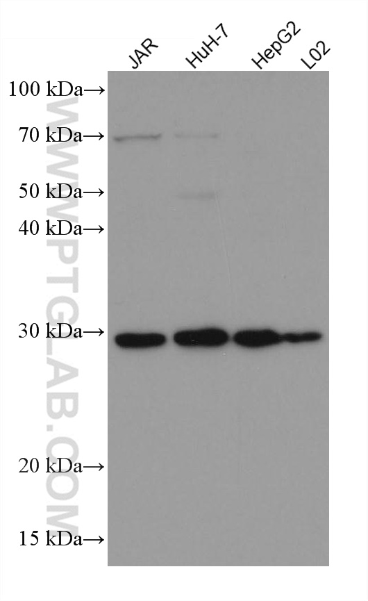 WB analysis using 67496-1-Ig