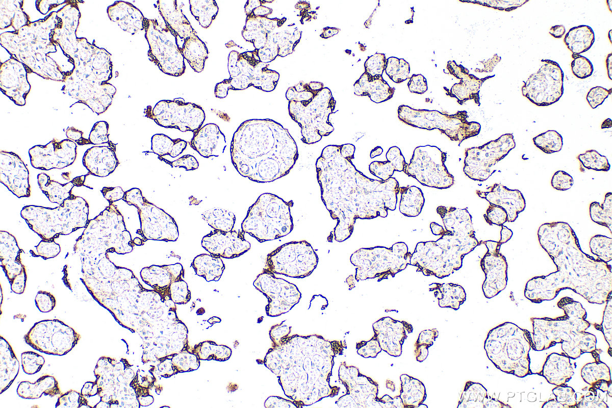 IHC staining of human placenta using 32642-1-AP IHC staining of human placenta using 32642-1-AP