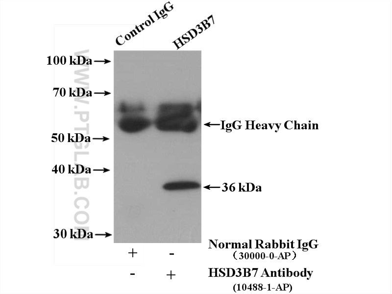 IP experiment of mouse liver using 10488-1-AP
