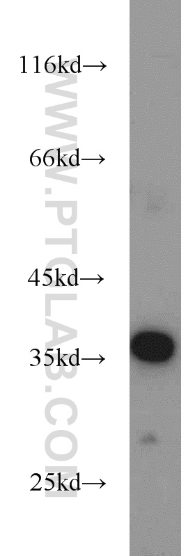 WB analysis of mouse liver using 10488-1-AP