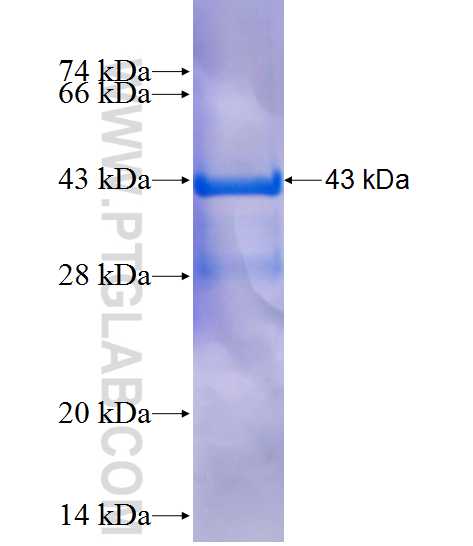 HSDL1 fusion protein Ag11007 SDS-PAGE HSDL1 fusion protein Ag11007 SDS-PAGE