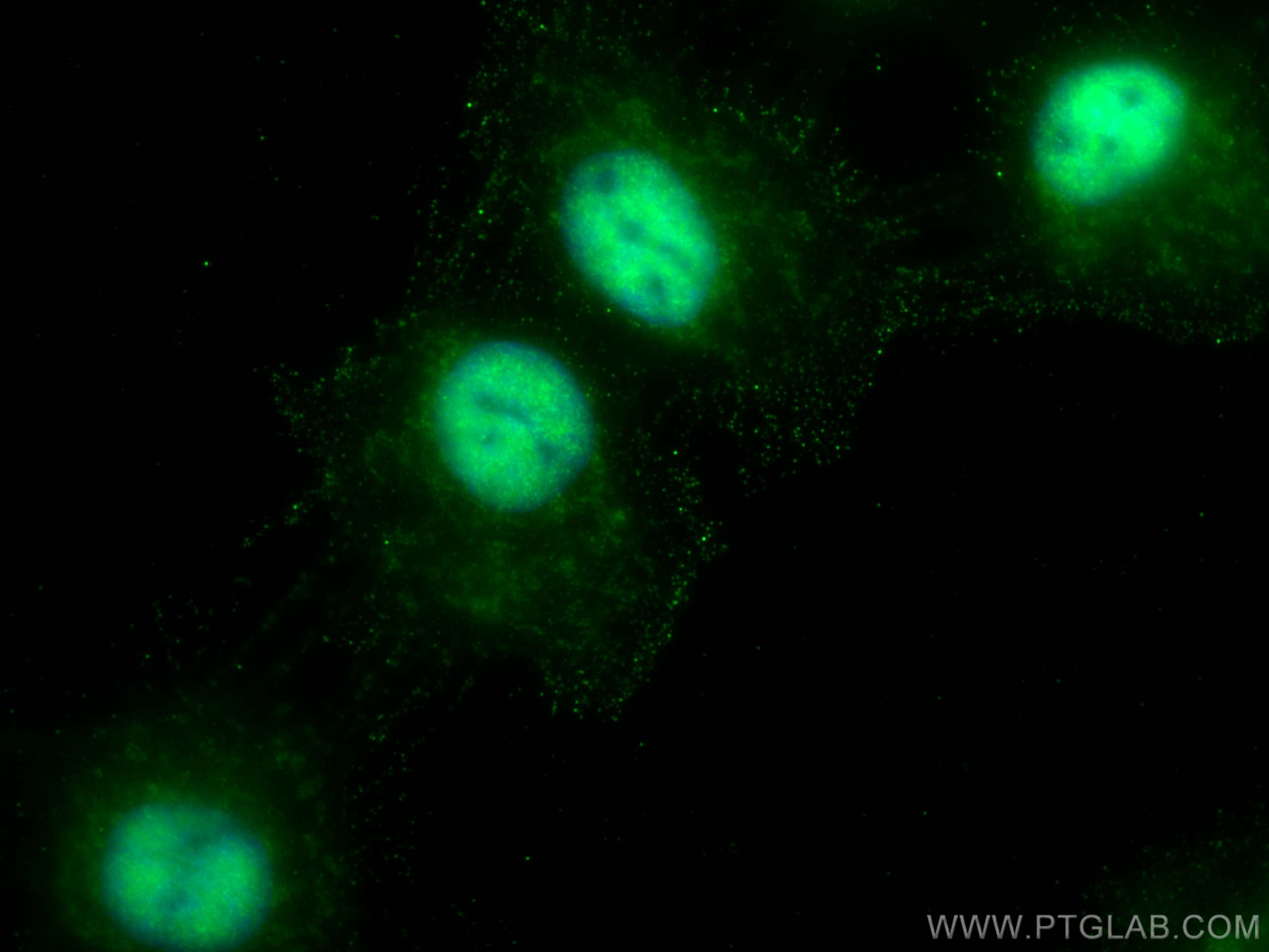 IF Staining of A431 using 51034-1-AP