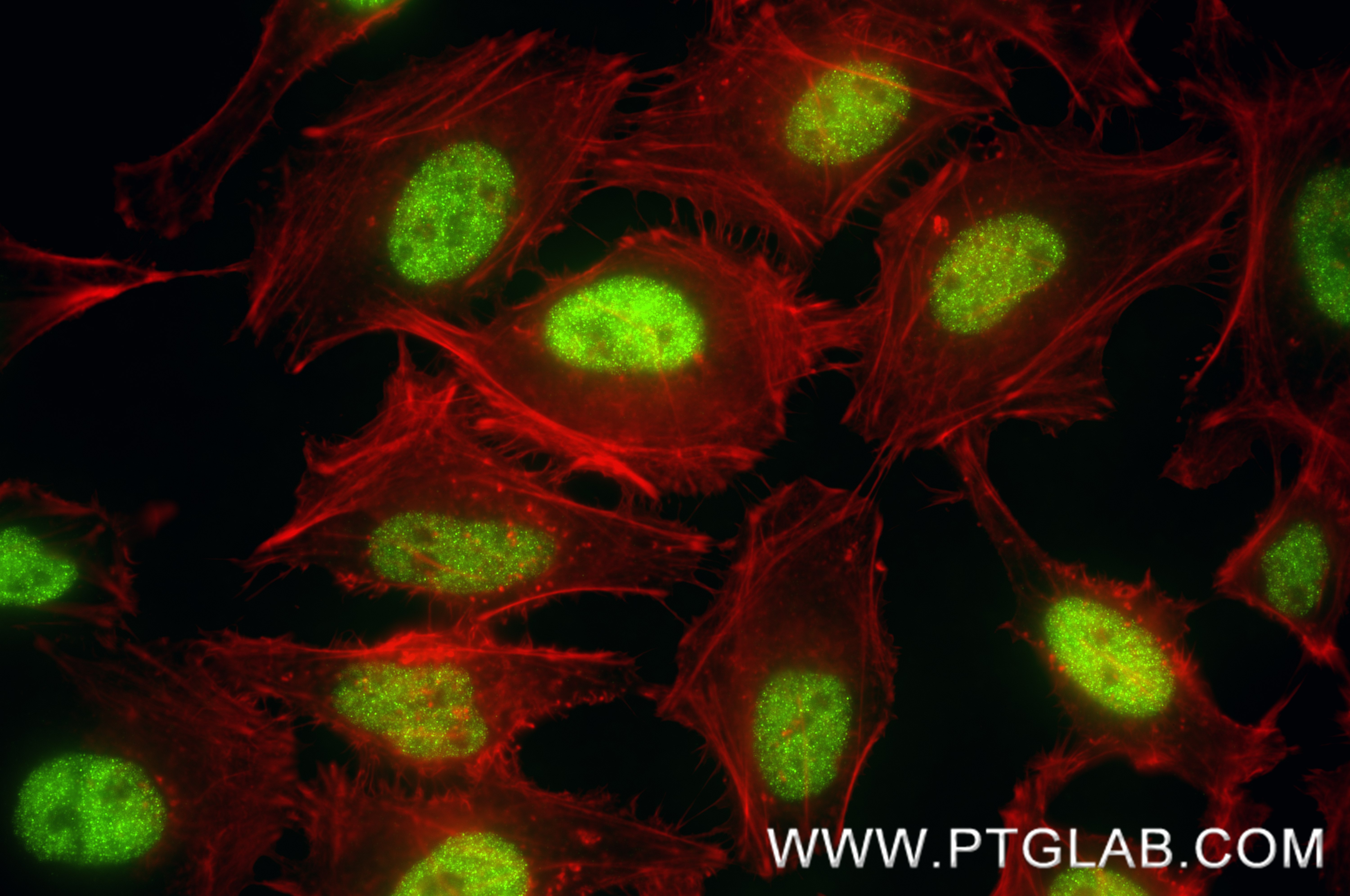 IF Staining of HeLa using 88318-1-RR (same clone as 88318-1-PBS) IF Staining of HeLa using 88318-1-RR (same clone as 88318-1-PBS)