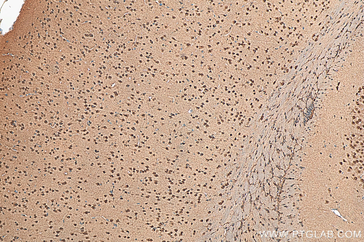 IHC staining of mouse brain using 22883-1-AP
