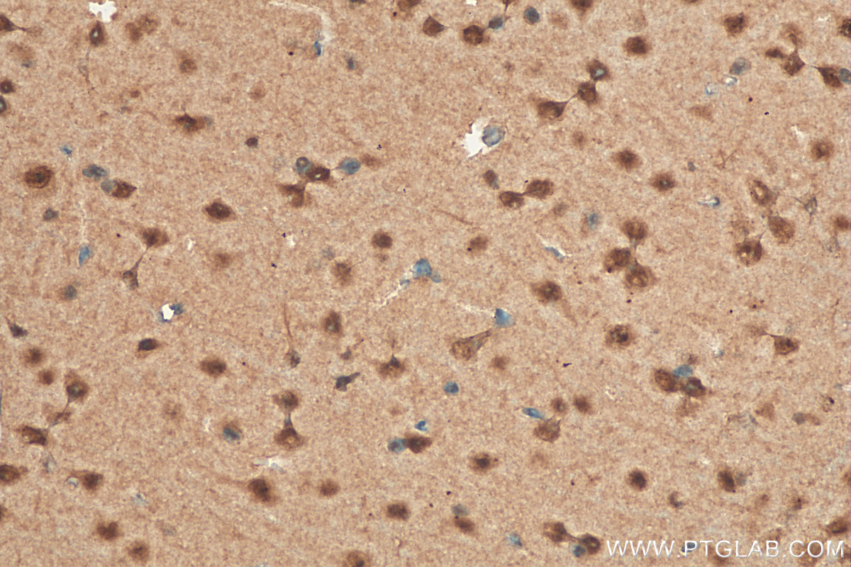 IHC staining of mouse brain using 22883-1-AP