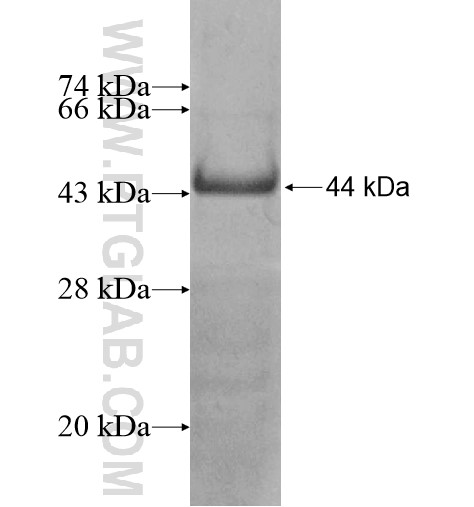 HSF5 fusion protein Ag11977 SDS-PAGE HSF5 fusion protein Ag11977 SDS-PAGE