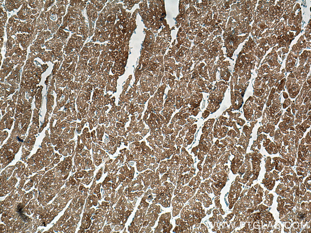 IHC staining of human heart using 67327-1-Ig (same clone as 67327-1-PBS)