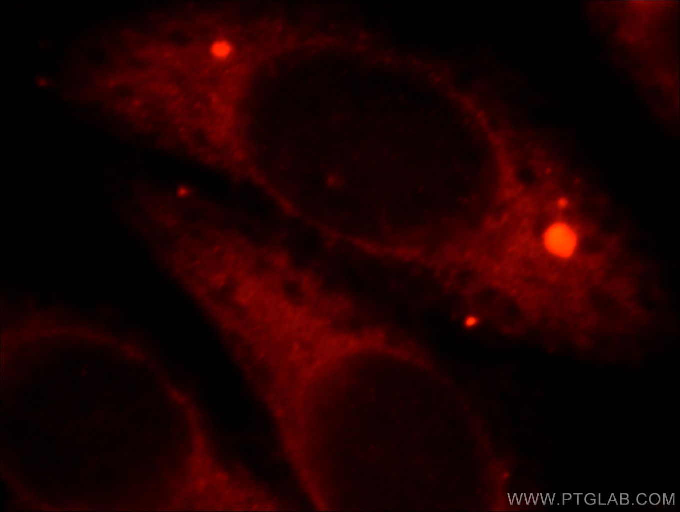 IF Staining of HepG2 using 21755-1-AP