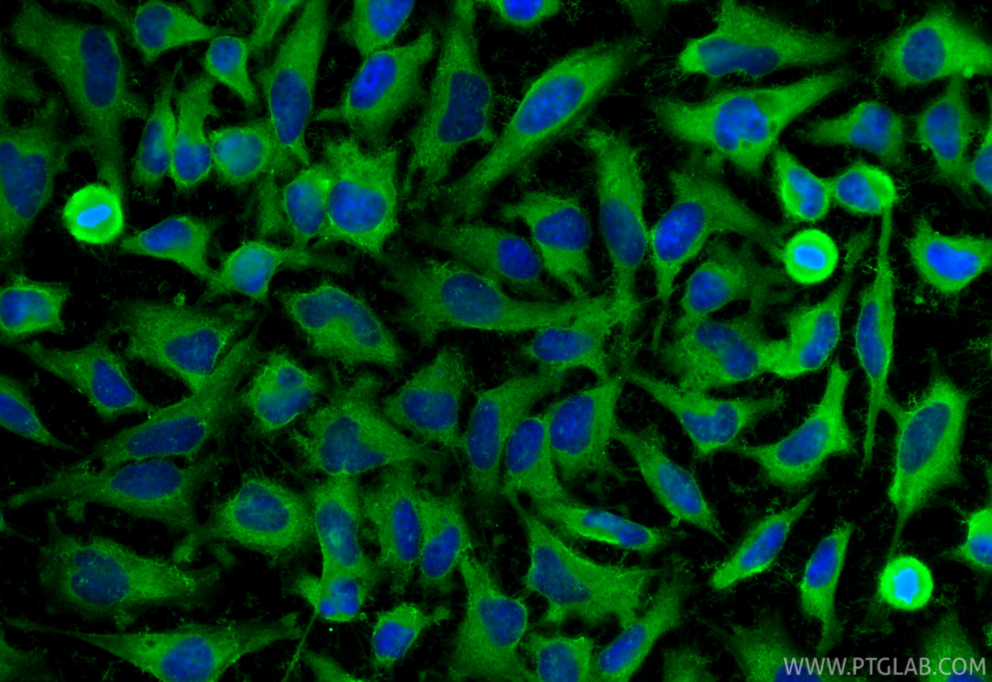 IF Staining of HeLa using RMX00089 IF Staining of HeLa using RMX00089