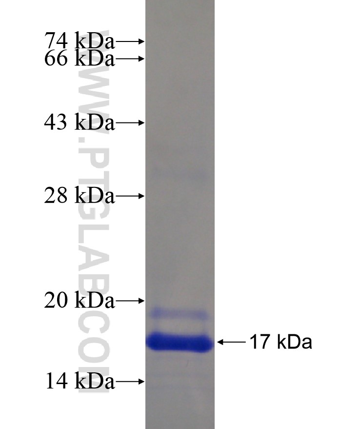 HSP27 fusion protein Ag17376 SDS-PAGE HSP27 fusion protein Ag17376 SDS-PAGE