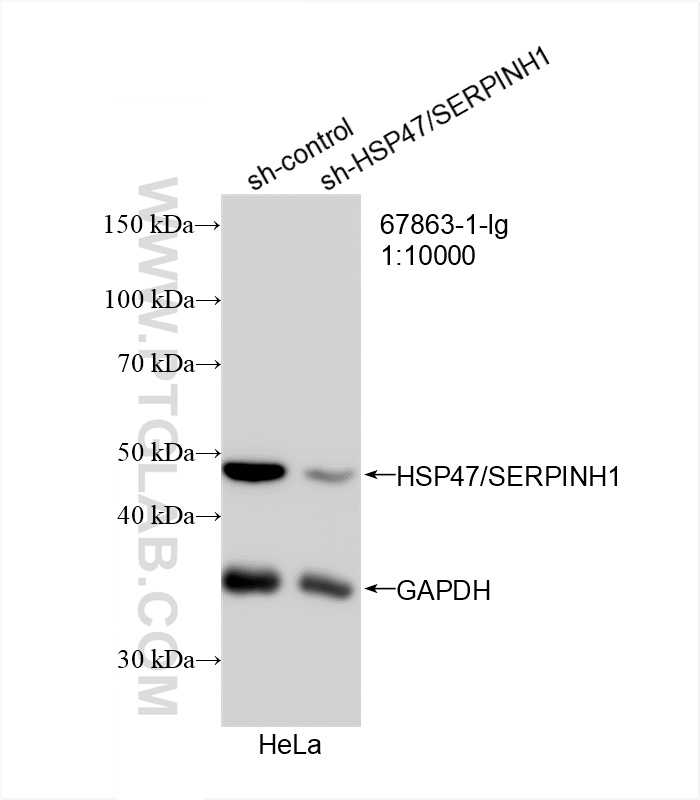 WB analysis of HeLa using 67863-1-Ig