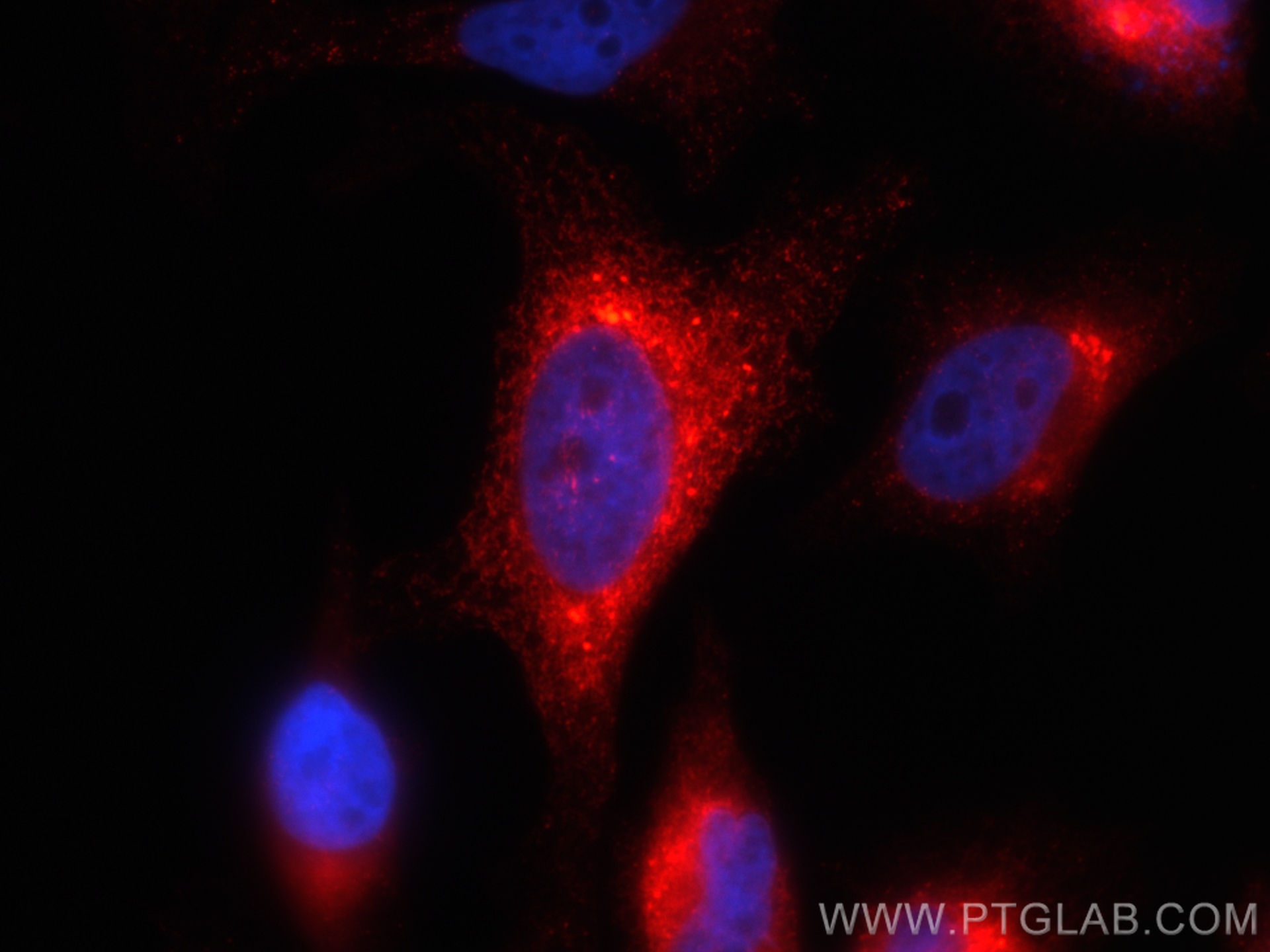 IF Staining of HeLa using CL594-67863