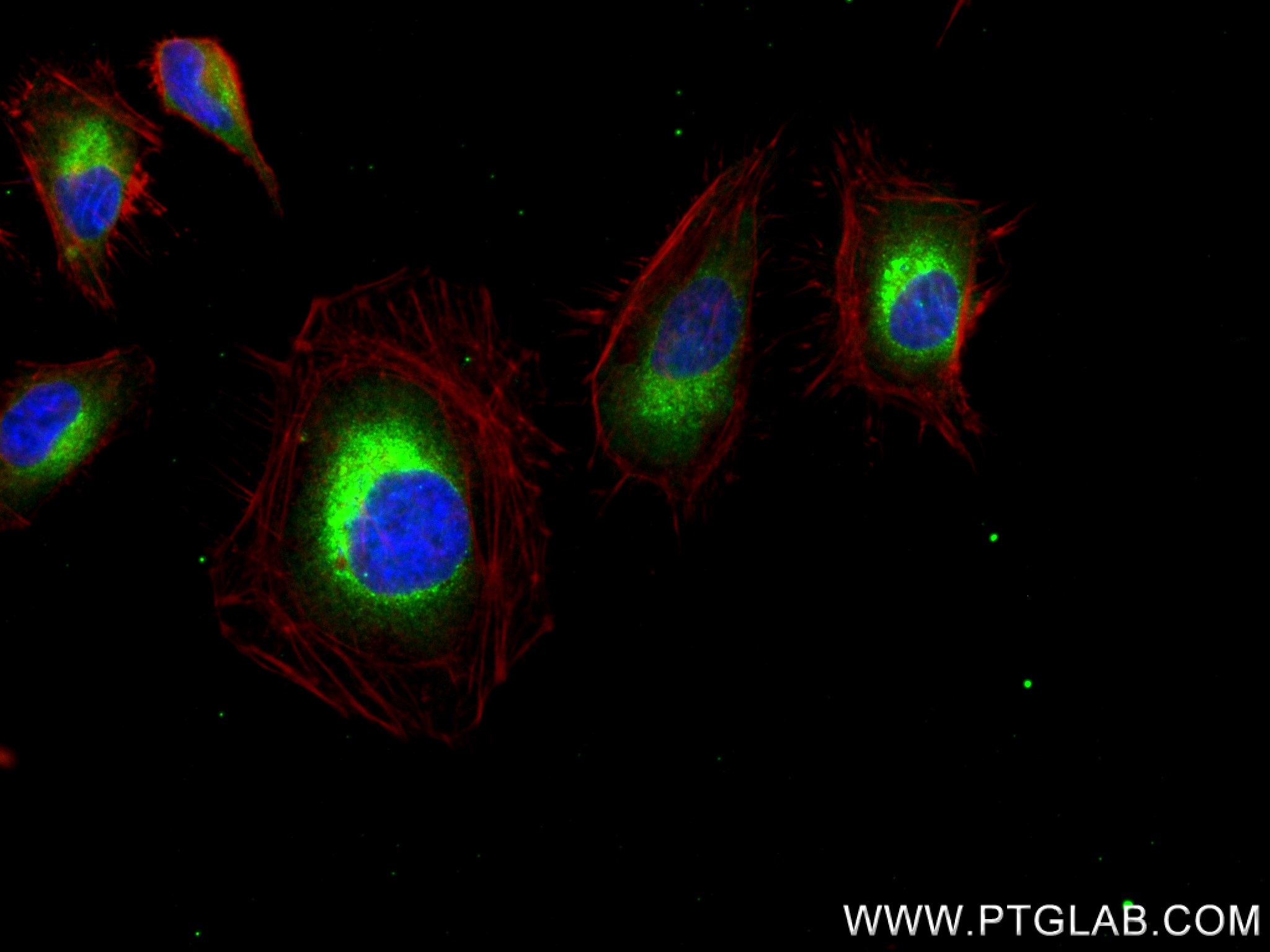 IF Staining of HeLa using 83689-4-RR