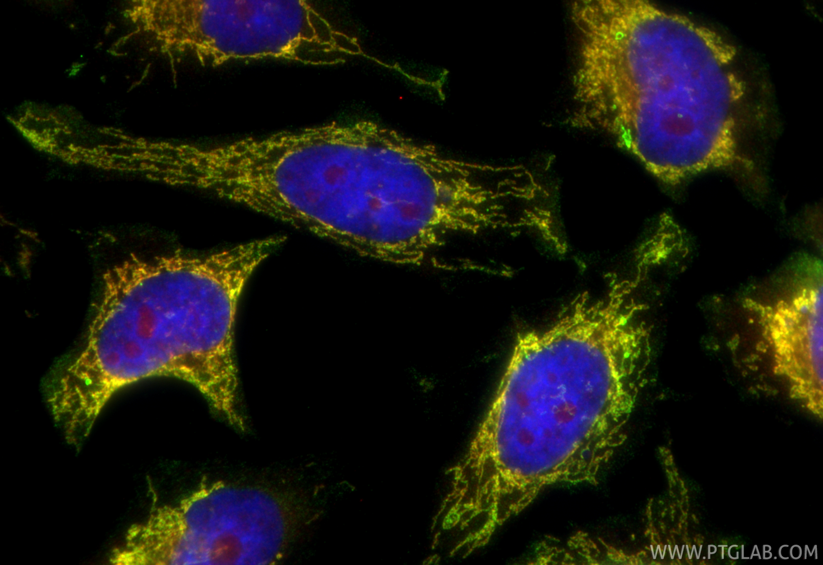 IF Staining of HeLa using CL488-66041
