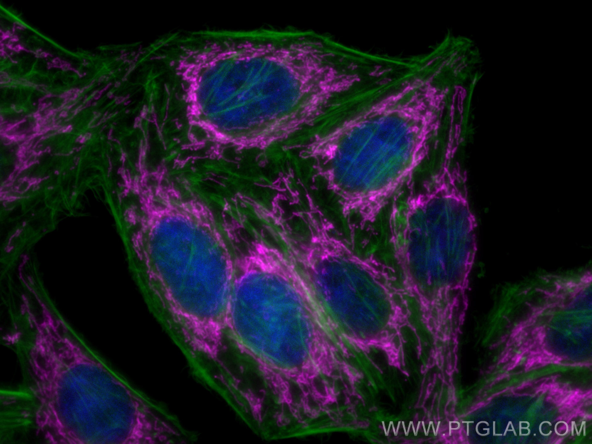 IF Staining of HepG2 using CL647-15282