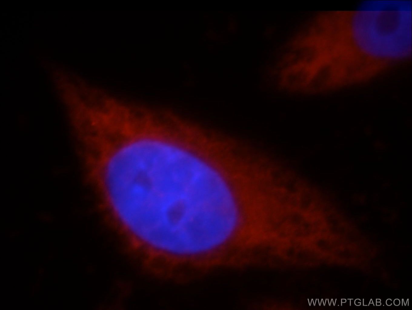 IF Staining of HepG2 using 21206-1-AP