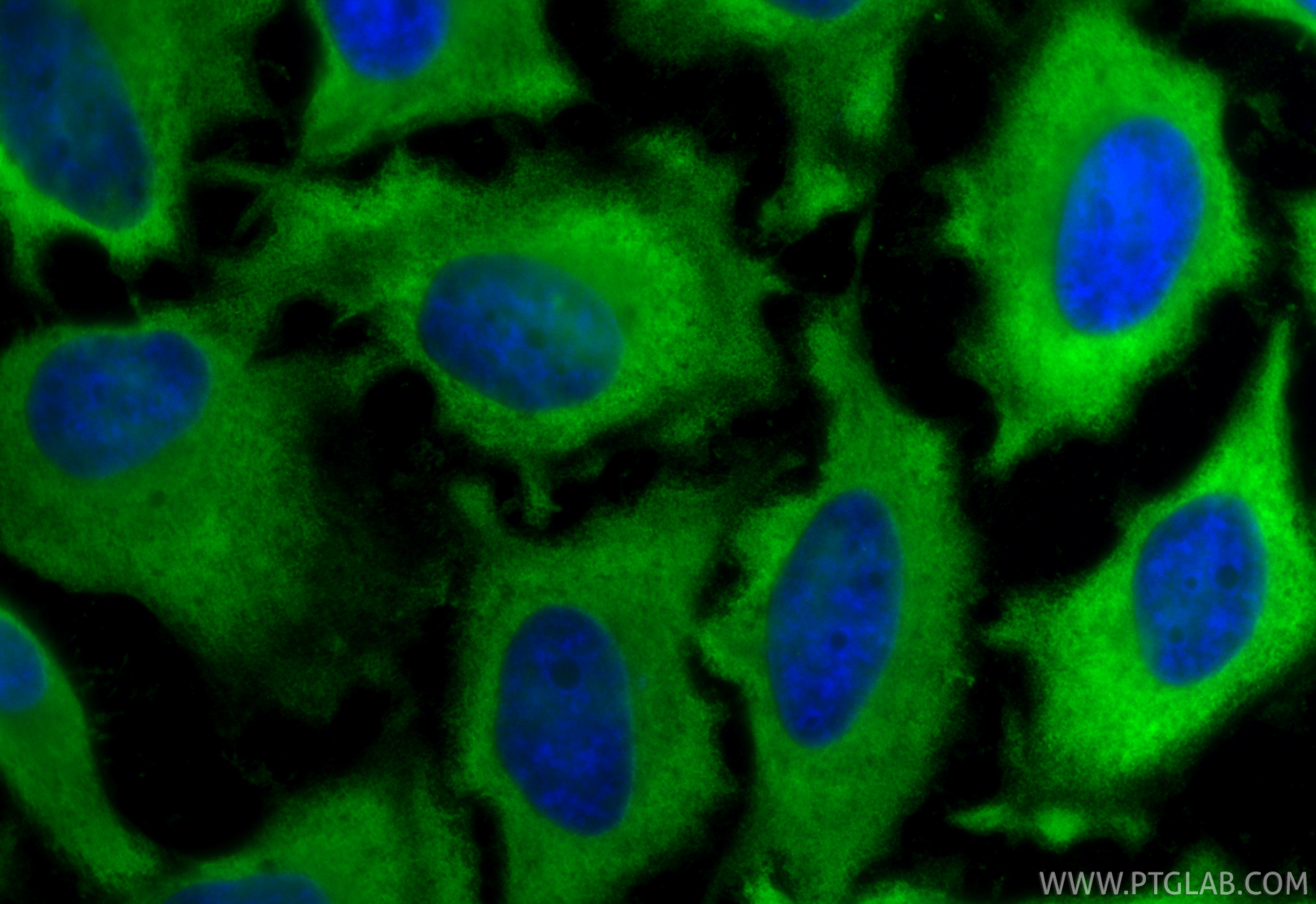 IF Staining of HeLa using 25405-1-AP