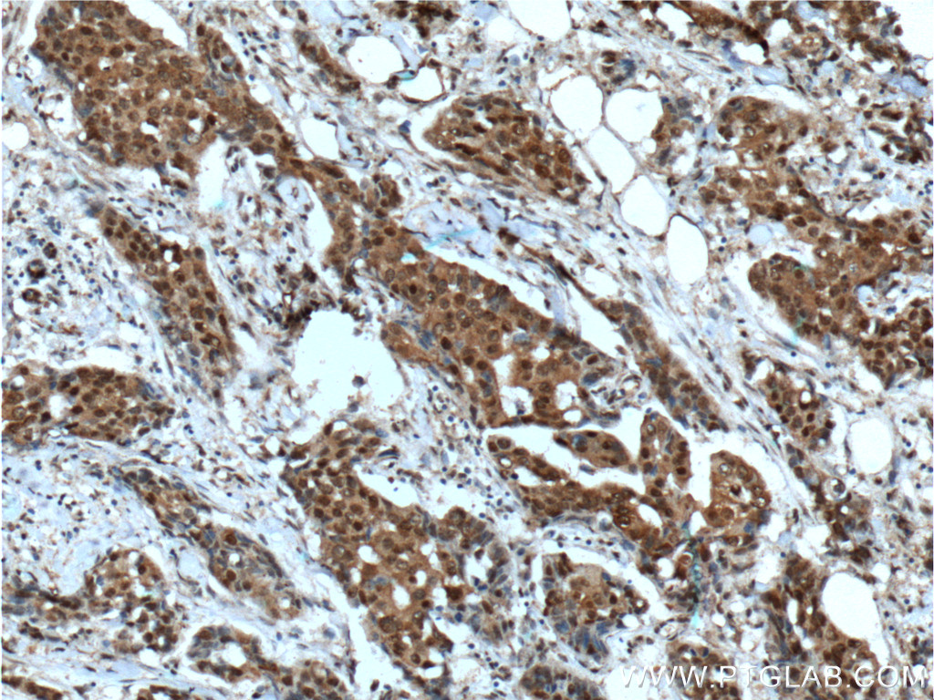 HSP70 Monoclonal antibody