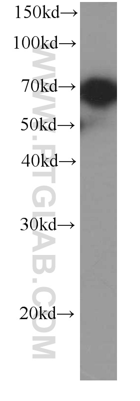 HSP70 Monoclonal antibody